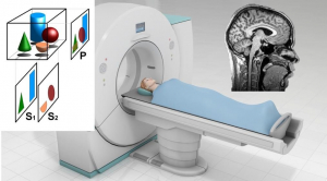 High-resolution X-ray tomography: current trends and challenges